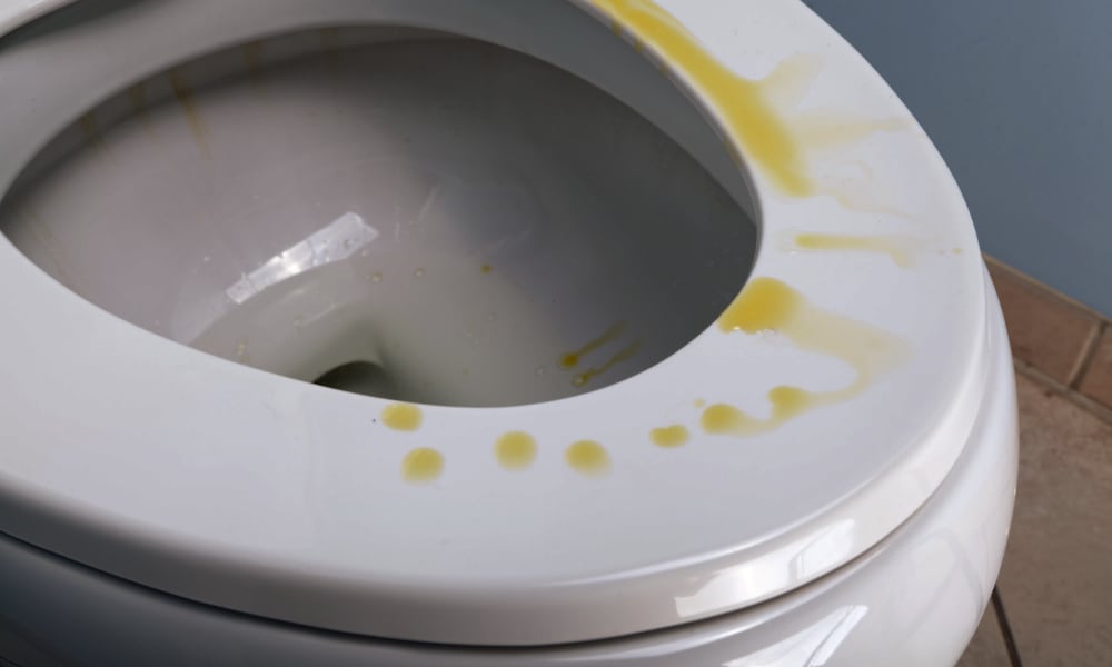 dirty toilet lid